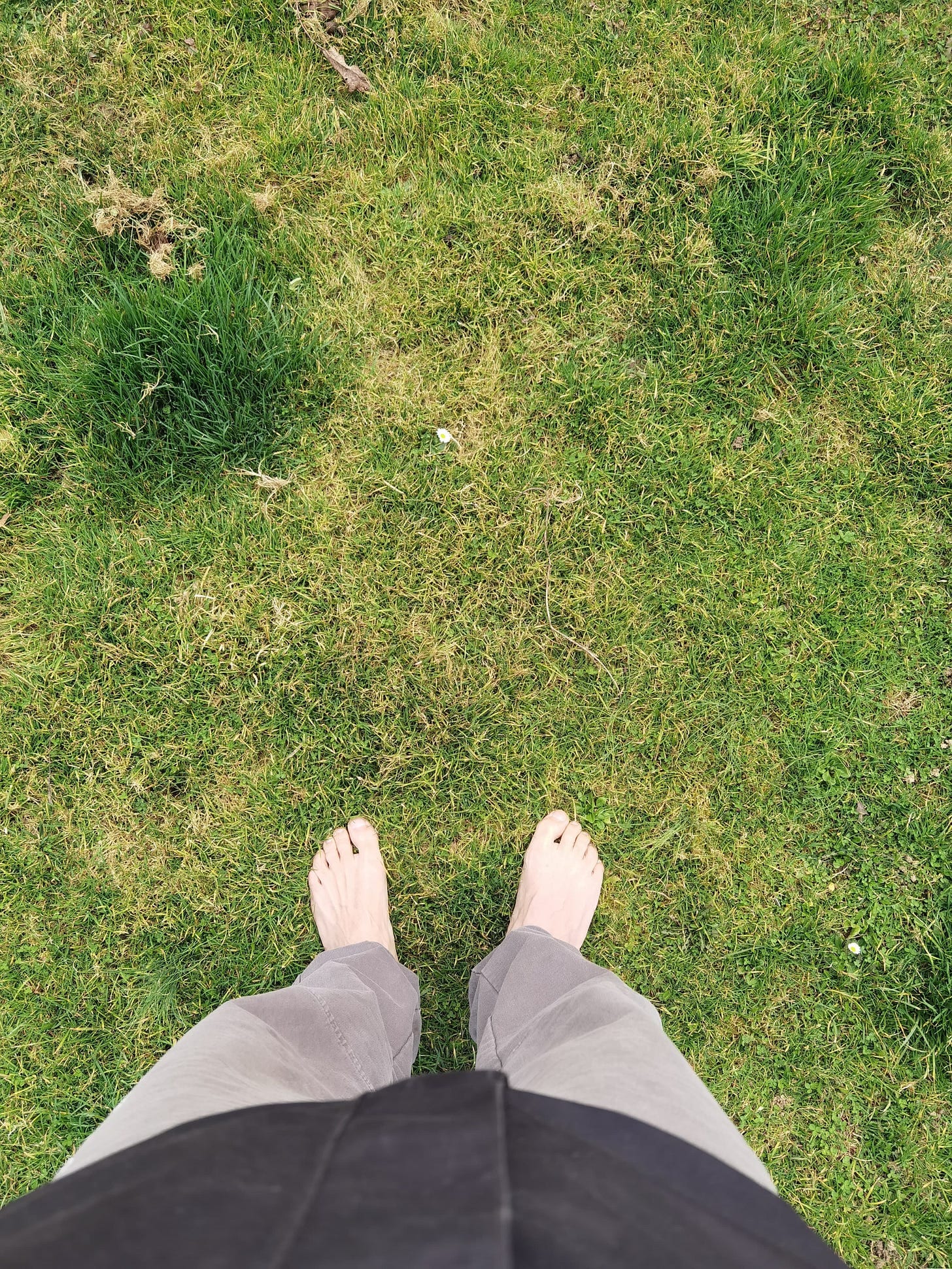 One of my favorite moments - around 10 days after the surgery, walking barefoot on the grass.